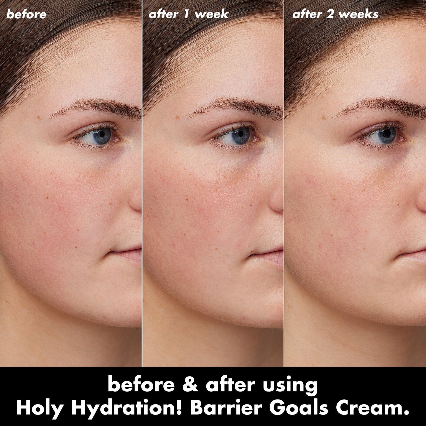 holy-hydration-barrier-goals-cream-mini-d4 0226_EDU_HHBarrierGoalsCream_B_A_Zoe_TRYPTICH_4f0e5b5d-35fb-4020-968e-244d4536afbd.jpg