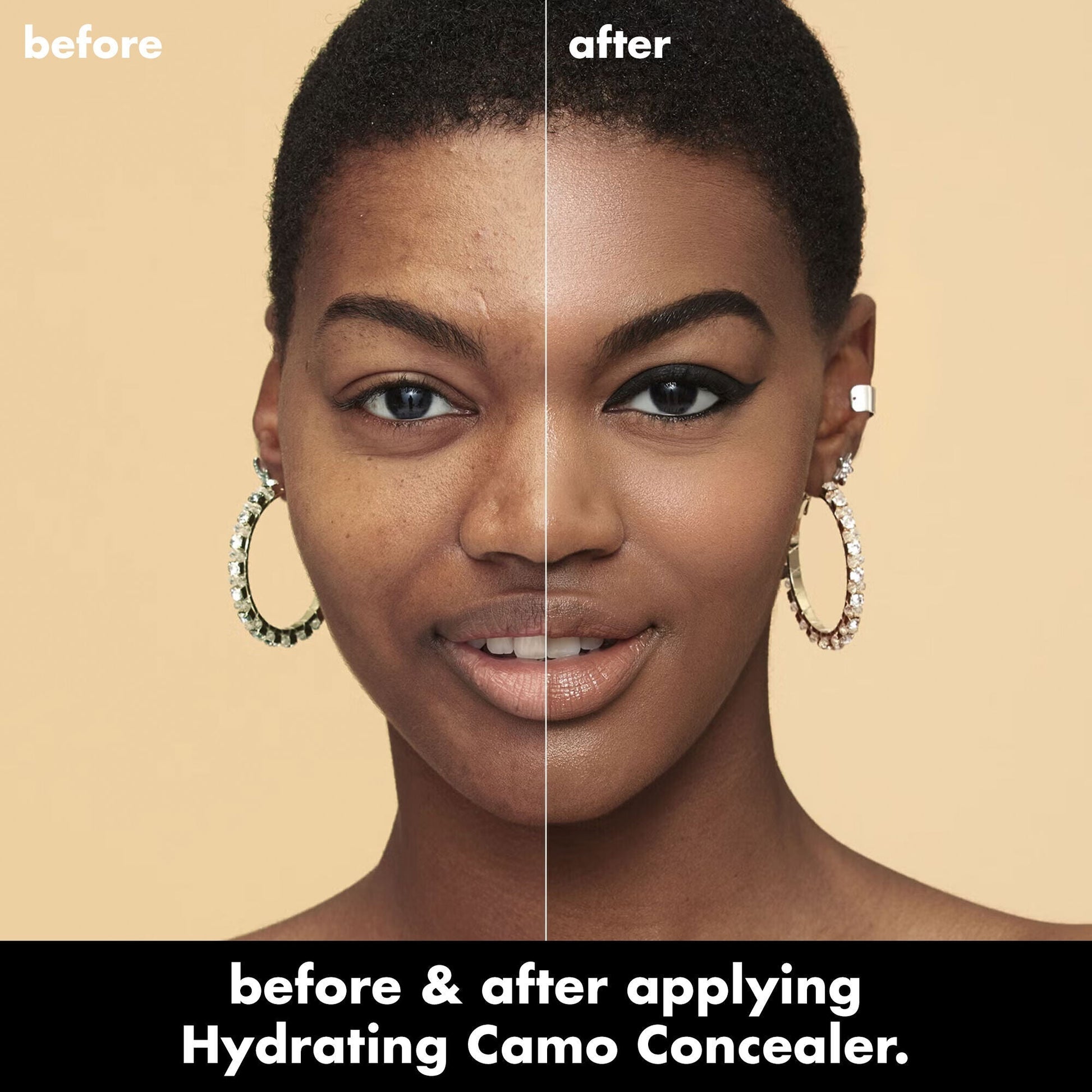 hydrating-camo-concealer-l4 0226_EDU_HydratingCamoConcelaer_BA_AshleyKaresh_20_1_d8499bbf-0e91-4173-b5e2-75127caf83a3.jpg