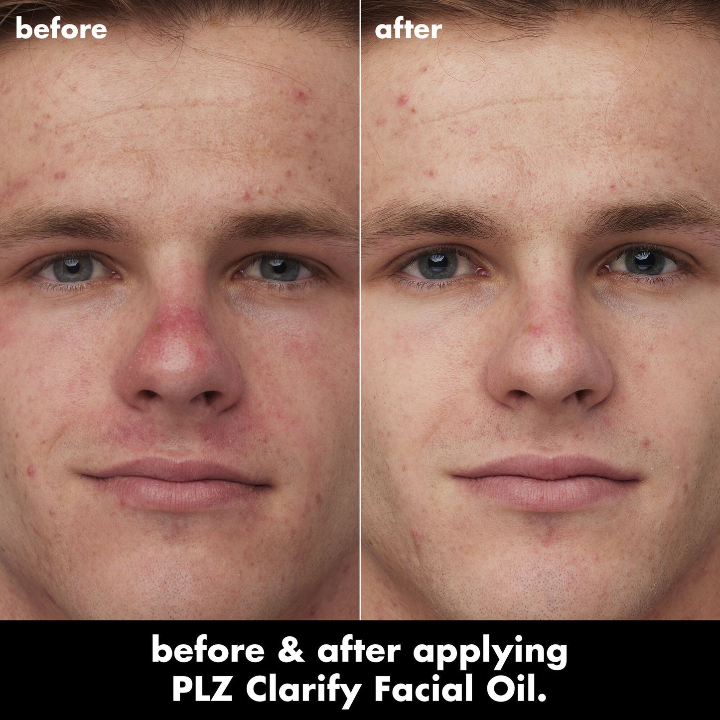 plz-clarify-facial-oil-o7 0326_EDU_PlzClarify_BA_Caleb.jpg