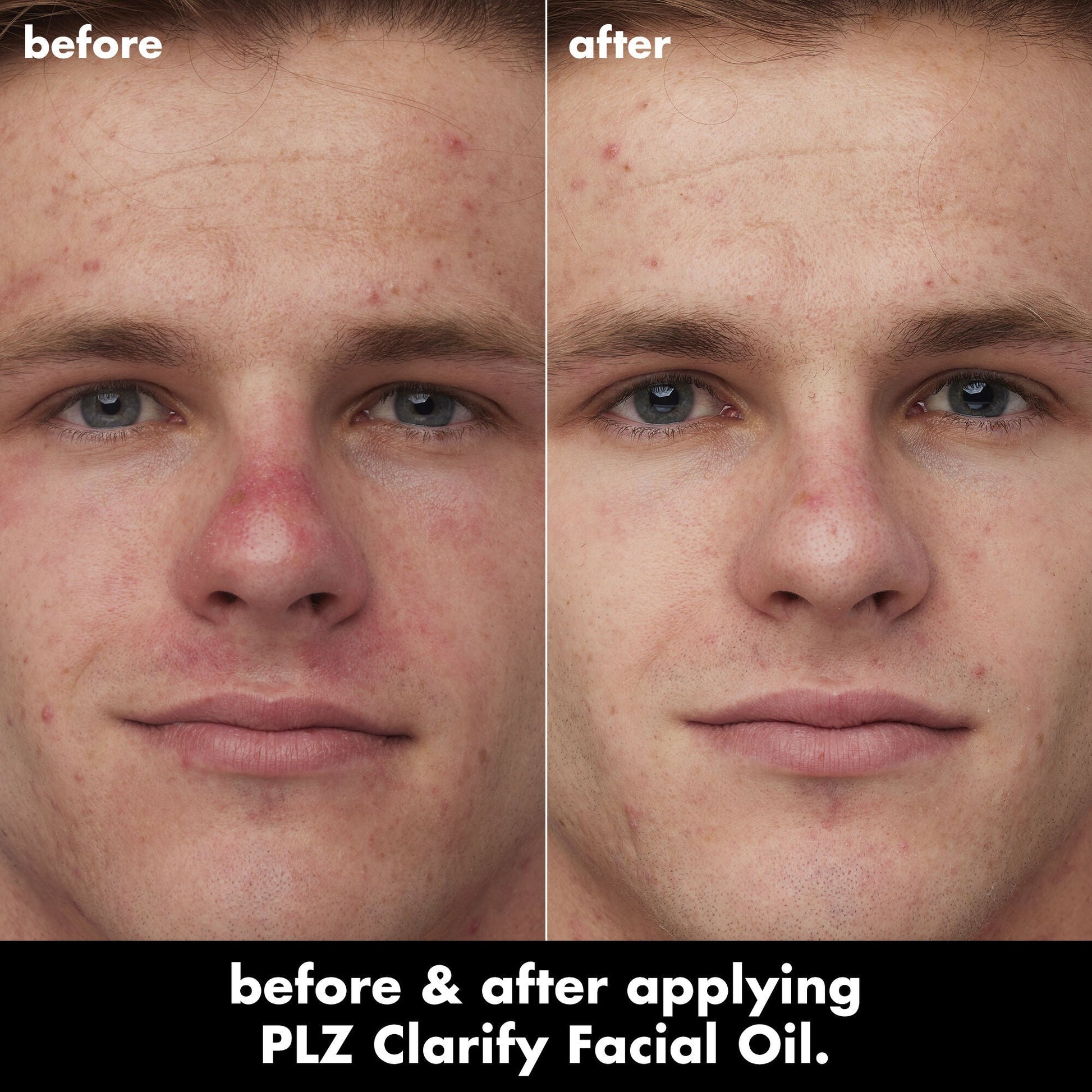 plz-clarify-facial-oil-o7 0326_EDU_PlzClarify_BA_Caleb.jpg