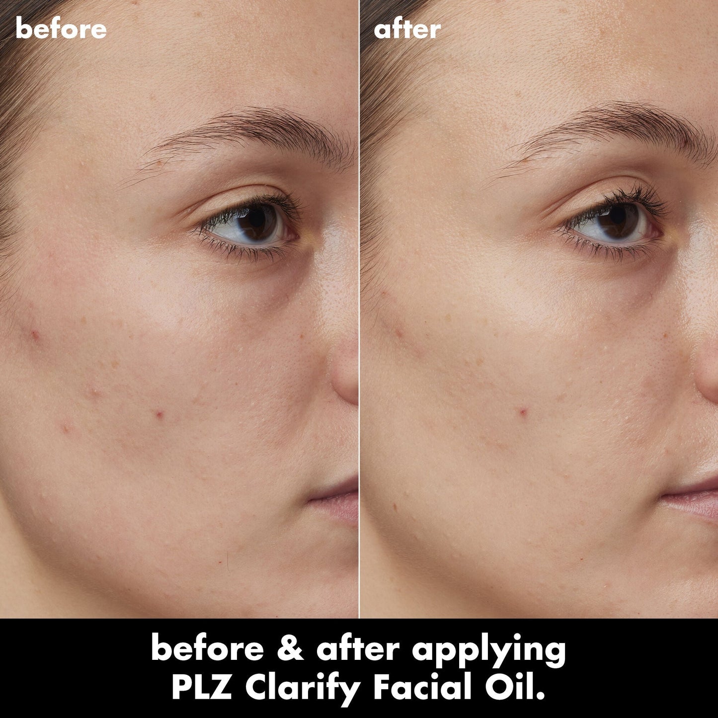 plz-clarify-facial-oil-o7 0326_EDU_PlzClarify_BA_Kelly.jpg