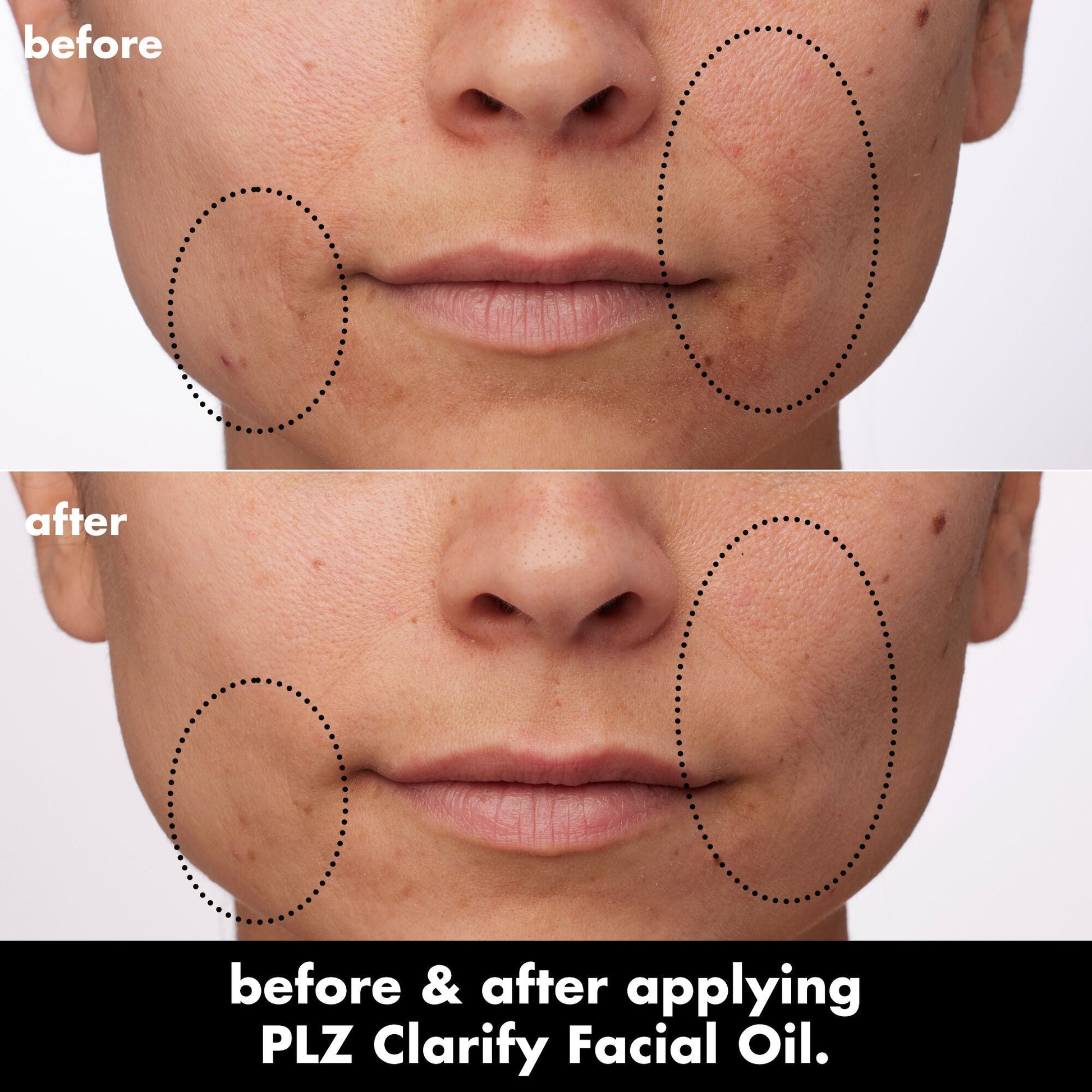 plz-clarify-facial-oil-o7 0326_EDU_PlzClarify_BA_Paula.jpg