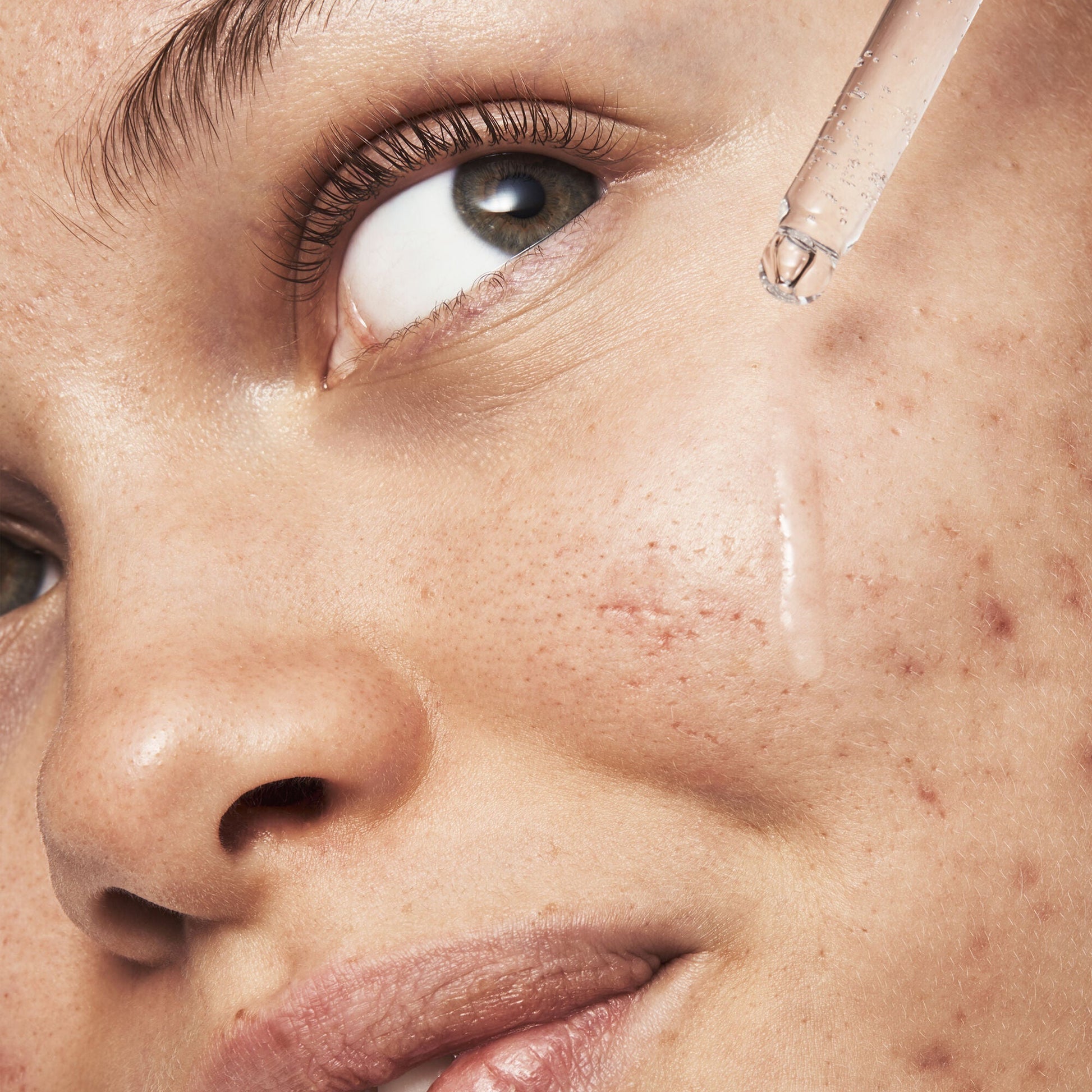 blemish-breakthrough-triple-acid-resurfacing-serum-h3 121321_Marley-Acne-Regimen_0254_FINAL_IGF.jpg